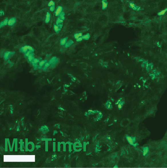 Supplementary Figure S8G Mtb-Timer Green